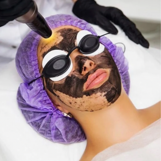 carbon peel fatiha beauty